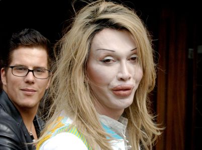 Pete Burns