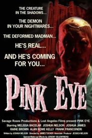Pink Eye