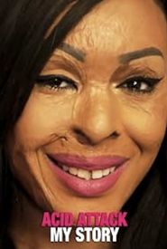 Acid Attack: My Story