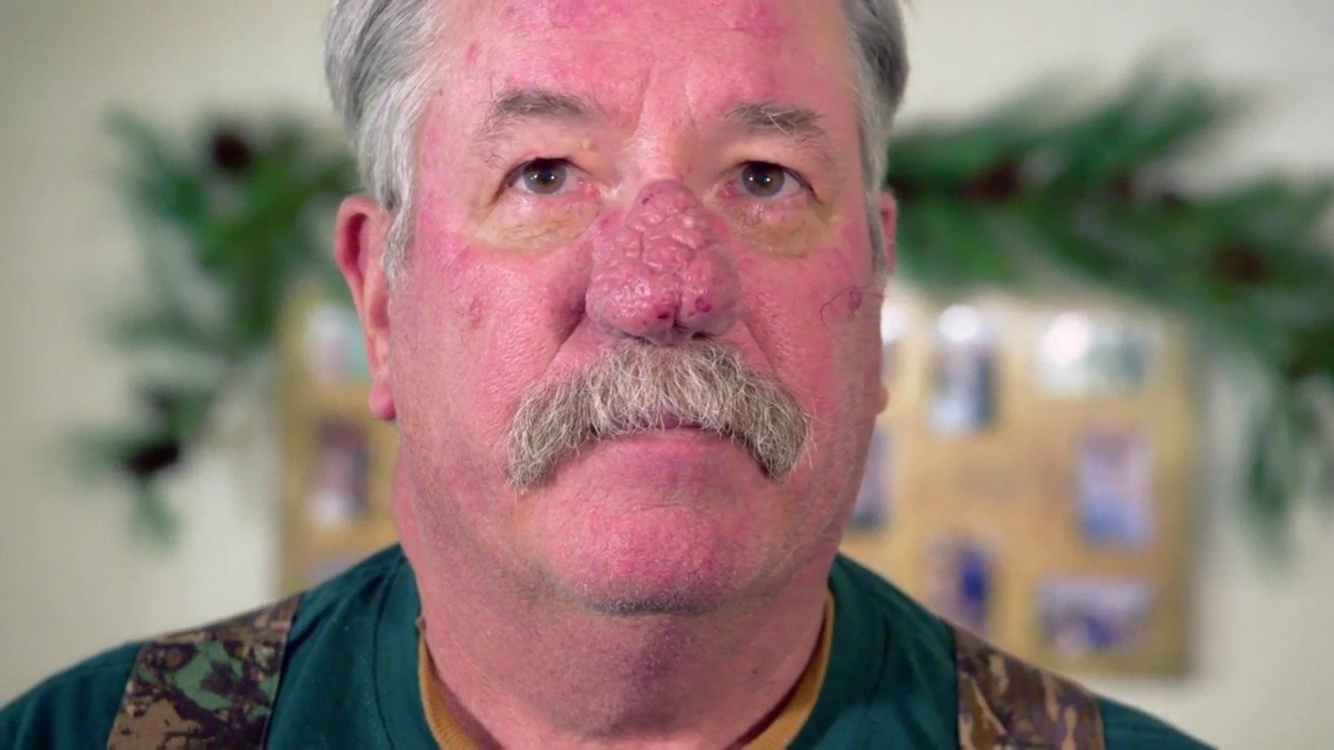 Dr. Pimple Popper background