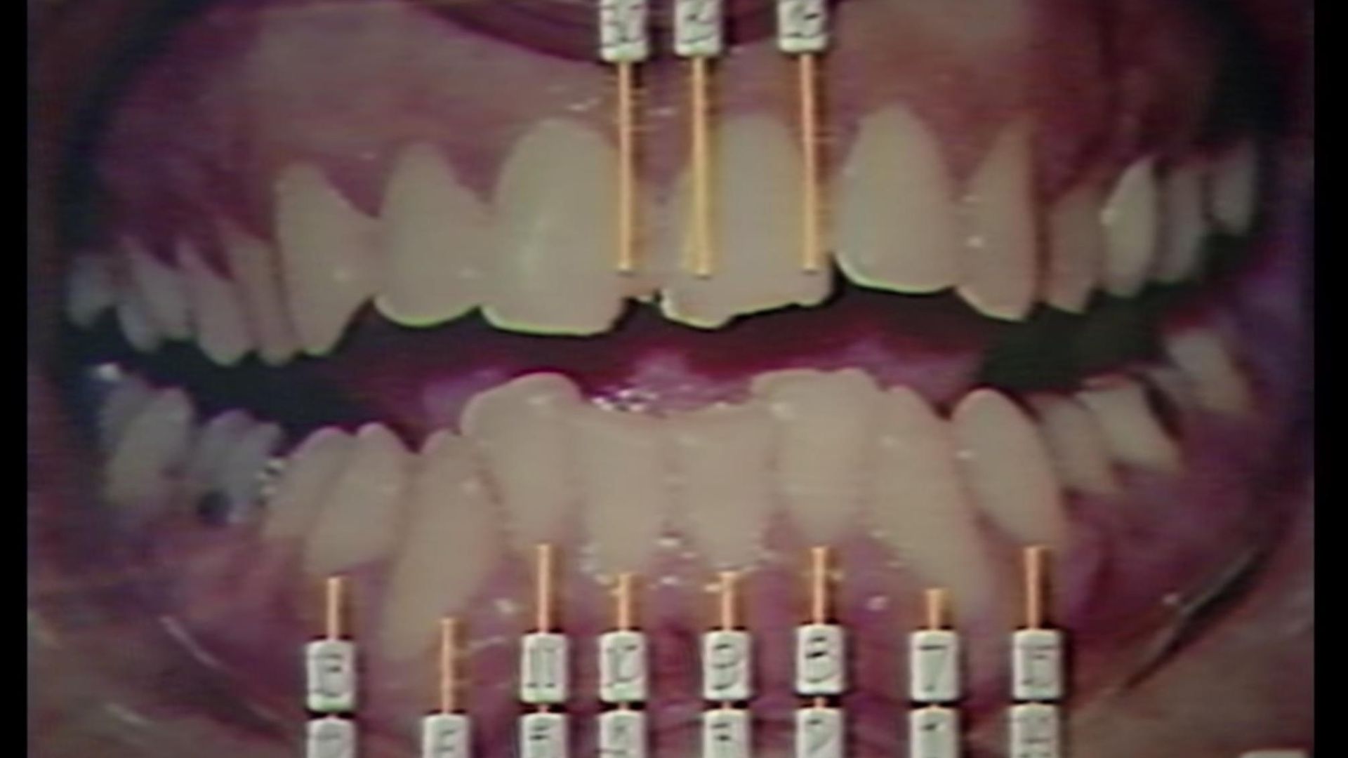 Conversations with a Killer: The Ted Bundy Tapes background