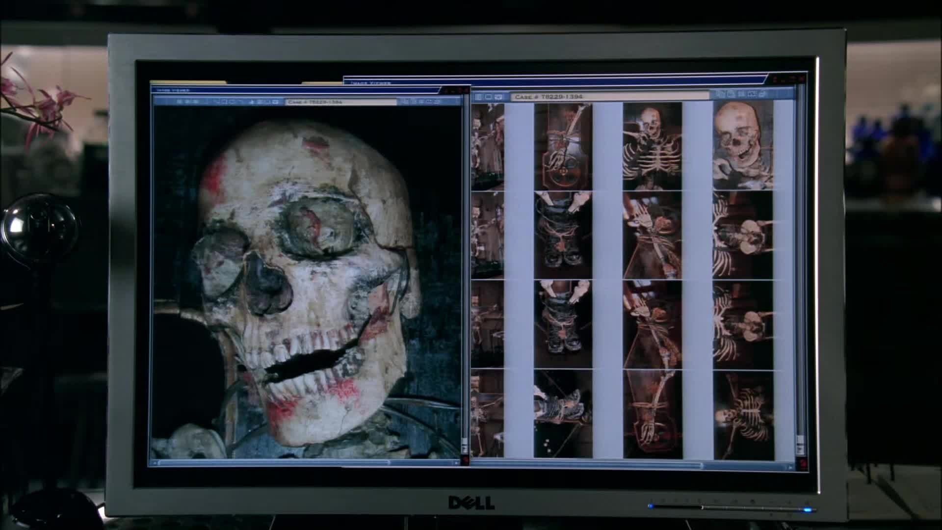 Bones background