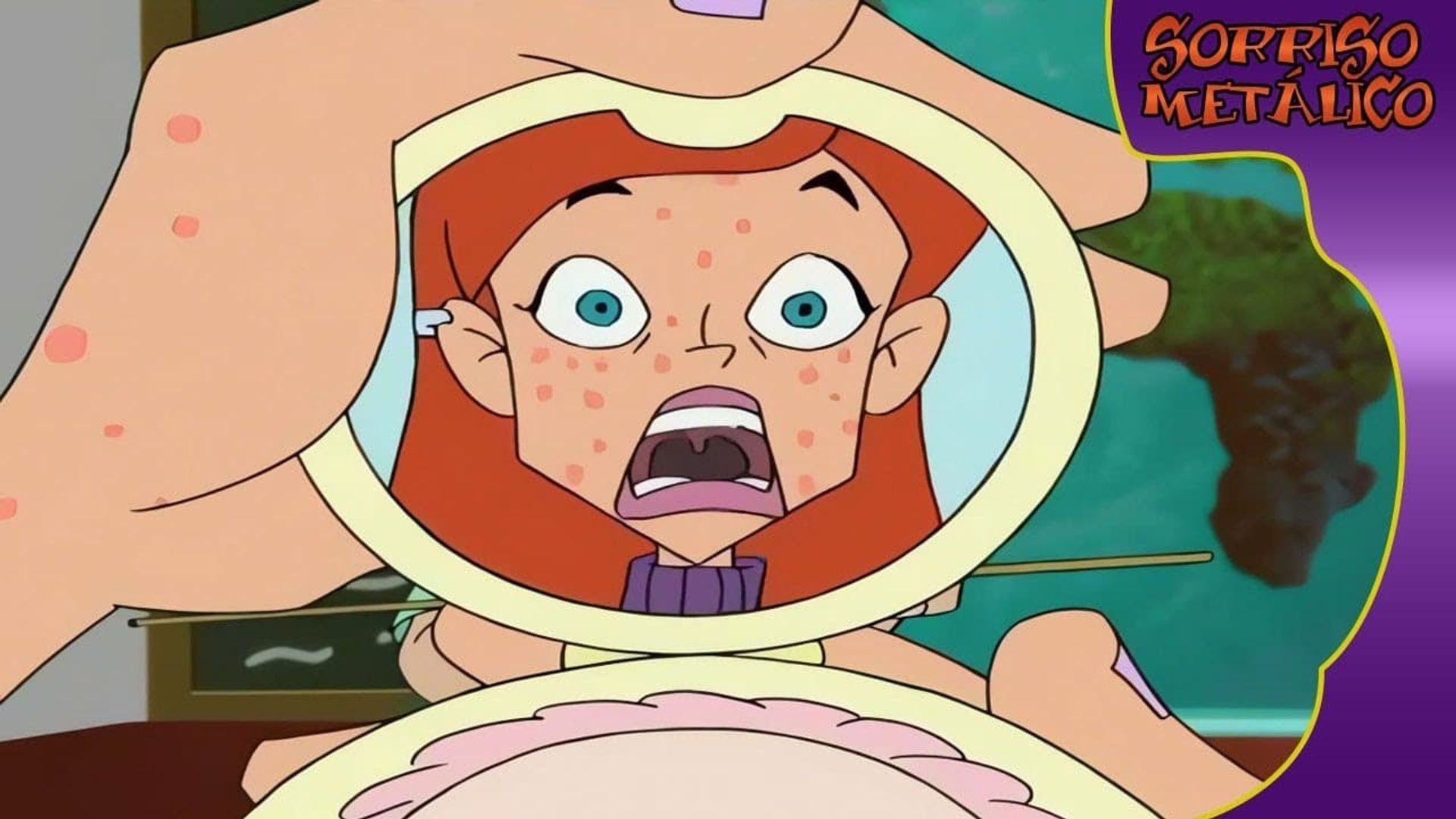 Braceface background
