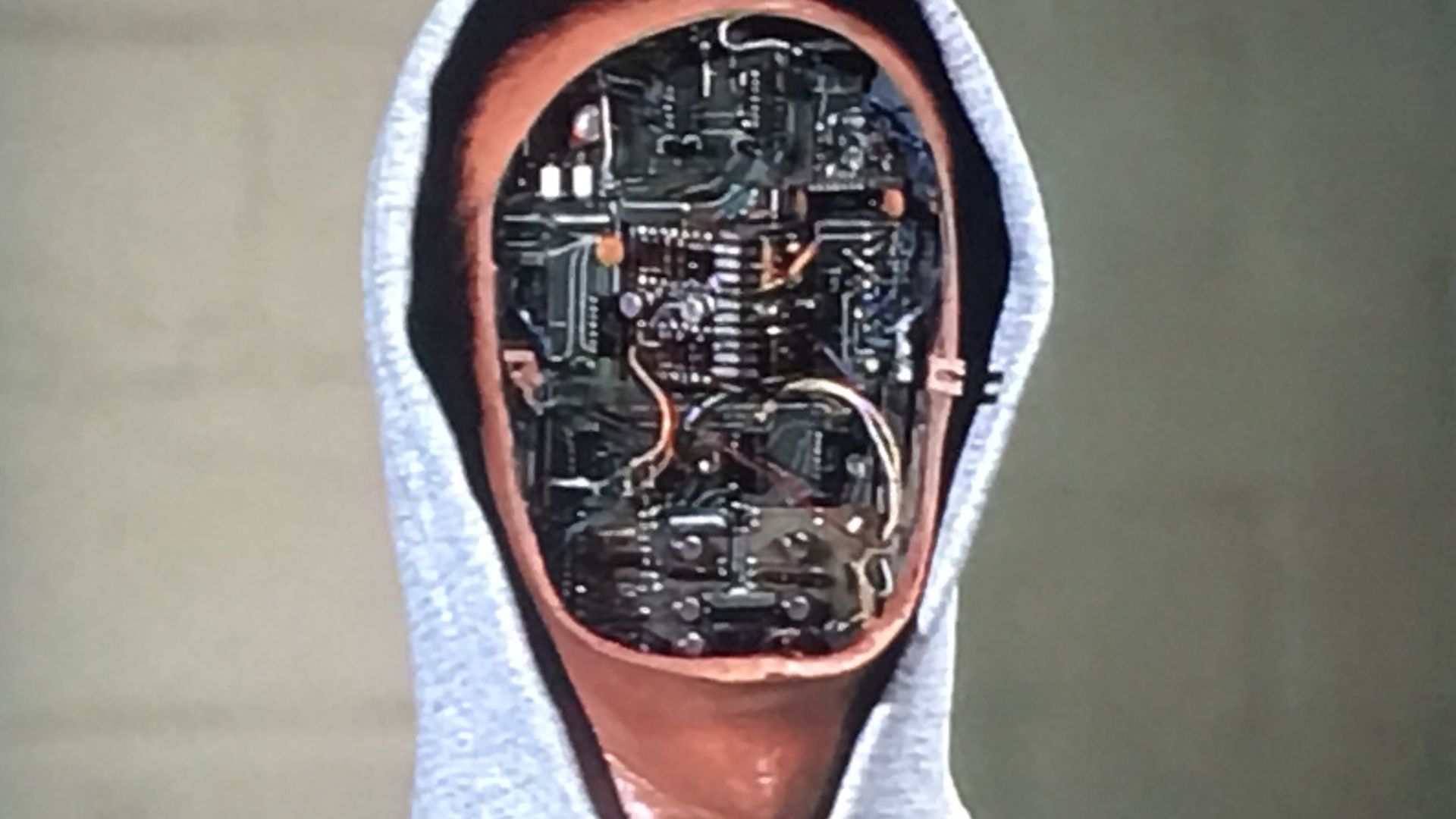 The Six Million Dollar Man background