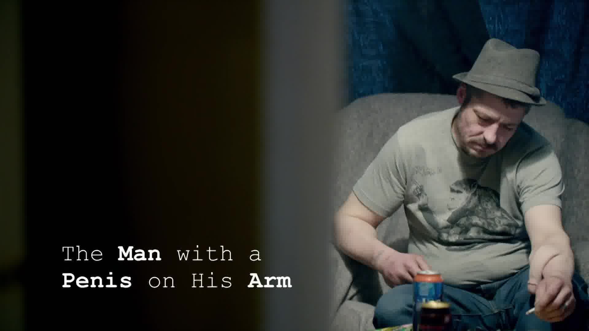The Man with a Penis on His Arm background