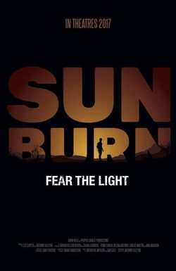 Sunburn