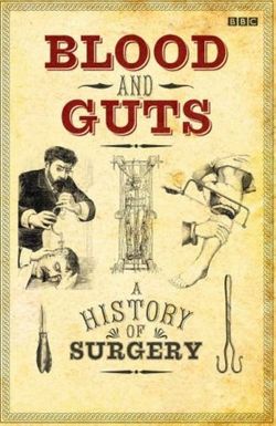 Blood and Guts: A History of Surgery