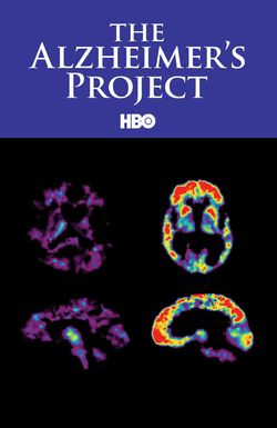 The Alzheimer's Project
