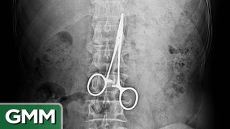 Episode 106 10 Crazy Things Swallowed by People