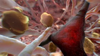 Episode 19 Can Alzheimer's Be Stopped?