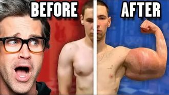Episode 24 Reacting To Extreme Before And After Photos