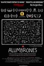 Alumbrones