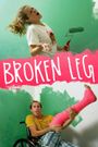 Broken Leg
