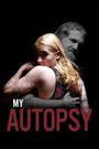 My Autopsy