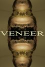 Veneer