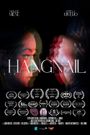 Hangnail